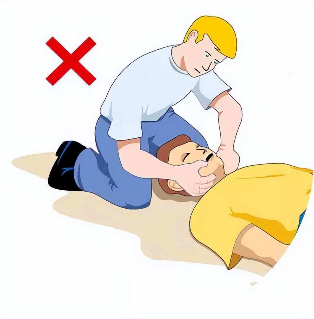 癫痫小发作视频,癫痫发作怎么办