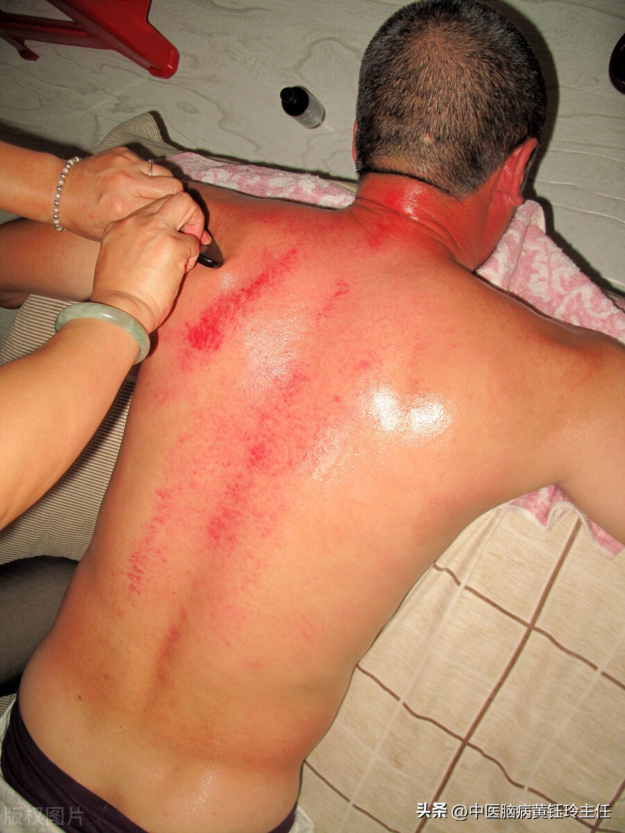 中医面部刮痧祛斑视频教程,想学中医按摩刮痧应该怎么学