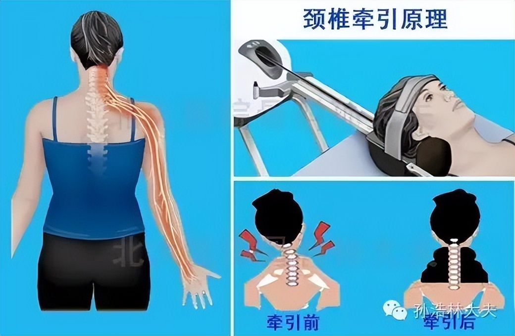 肩关节痛应与什么病鉴别,肩痛有可能是患上哪些病