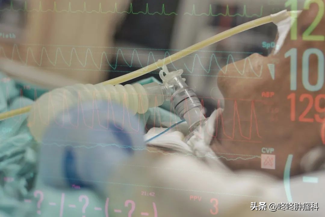 医者仁心肝癌,肝癌个案护理报告完整范文