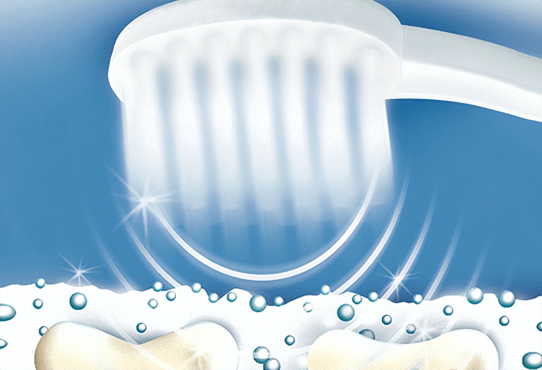 小米电动牙刷和拜尔电动牙刷,usmile电动牙刷和飞利浦电动牙刷