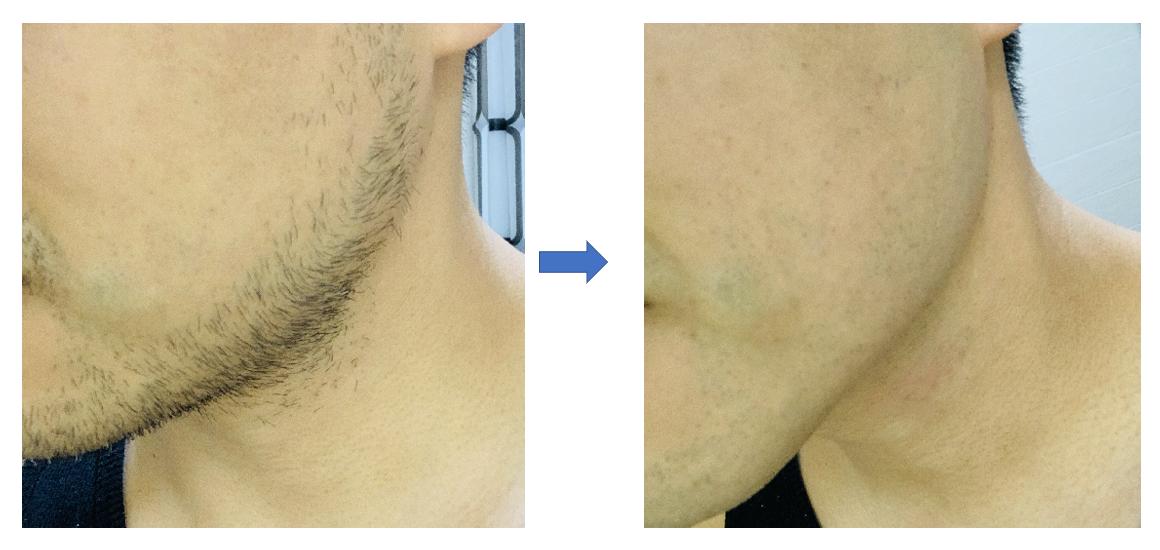 松下6刀头刮胡刀真实测评,松下6刀头剃须刀怎么样