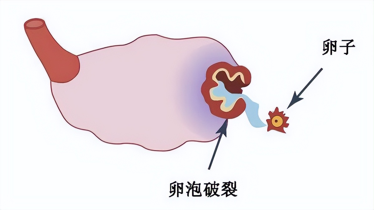 健康大姨妈量多是为什么,健康大姨妈量大