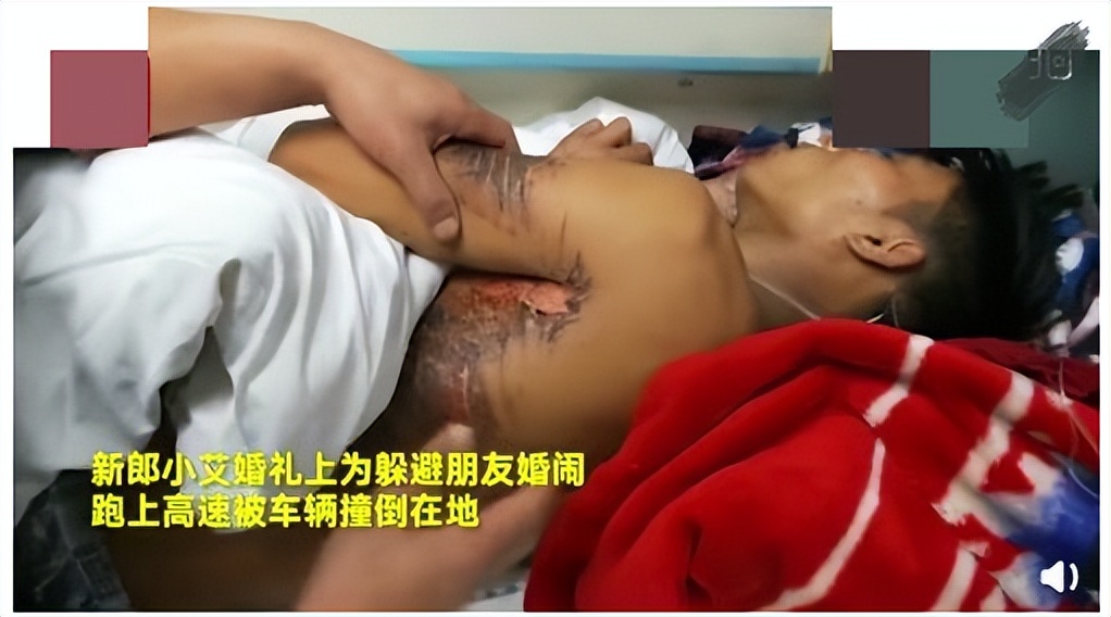 婚礼上公公醉酒当场亲新娘后续,醉酒公公暴打儿媳