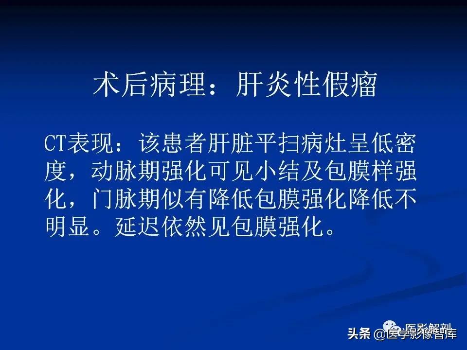 肝炎性假瘤鉴别诊断,肝炎性假瘤影像学表现