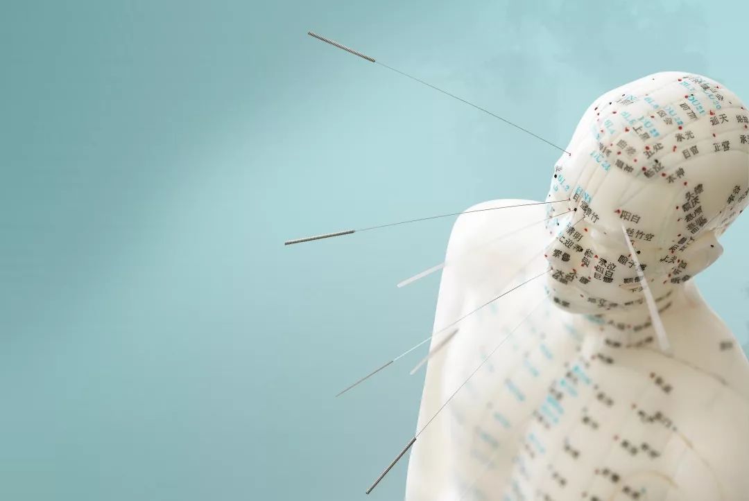 中医针灸治疗腰痛病的学术思想,古法针灸临床治验