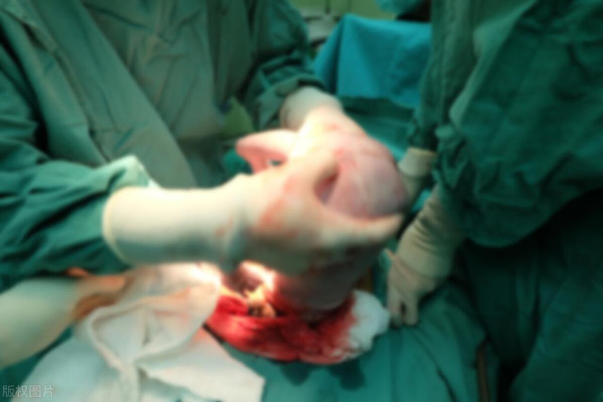 孕妇要求剖腹产医生可以拒绝吗,孕妇剖宫产必须家属同意吗