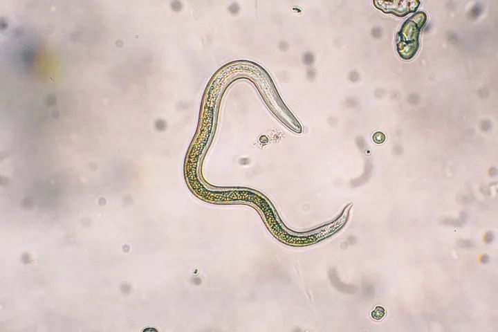 备孕前不做检查可以吗,备孕前哪些检查可以不做