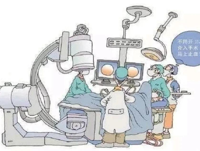 怎么治疗鼻出血,鼻出血介入治疗