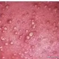 天气再热不能给孩子穿什么,孩子夏天特别热需要擦痱子粉吗