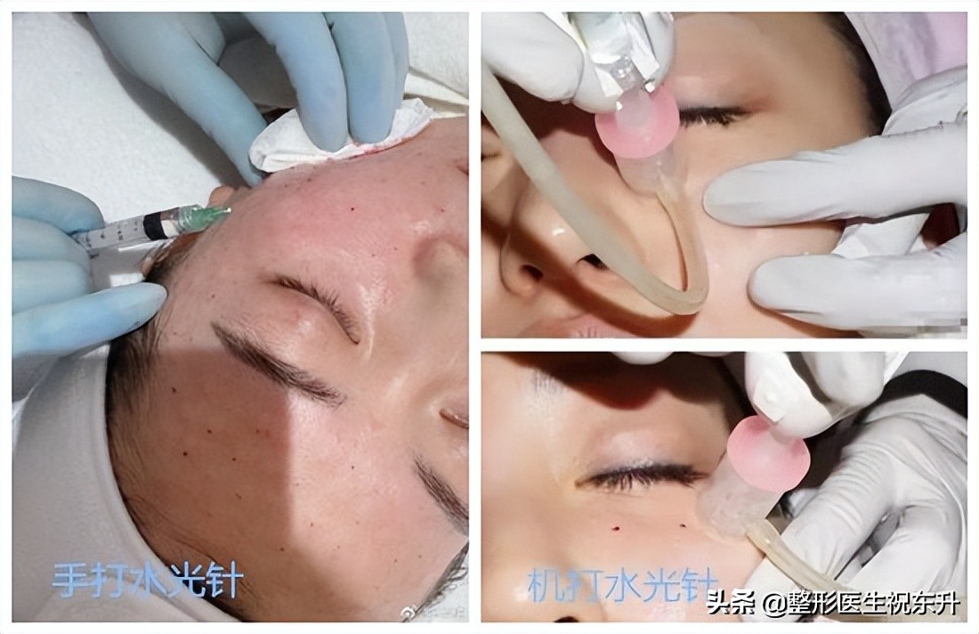 想做水光不知道怎么搭配,做水光针需要什么资质