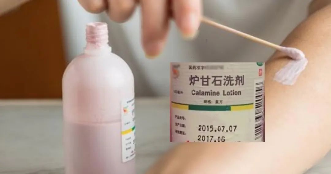 炉甘石洗剂开瓶多久不能用了,炉甘石洗剂开瓶过后保质期是多久