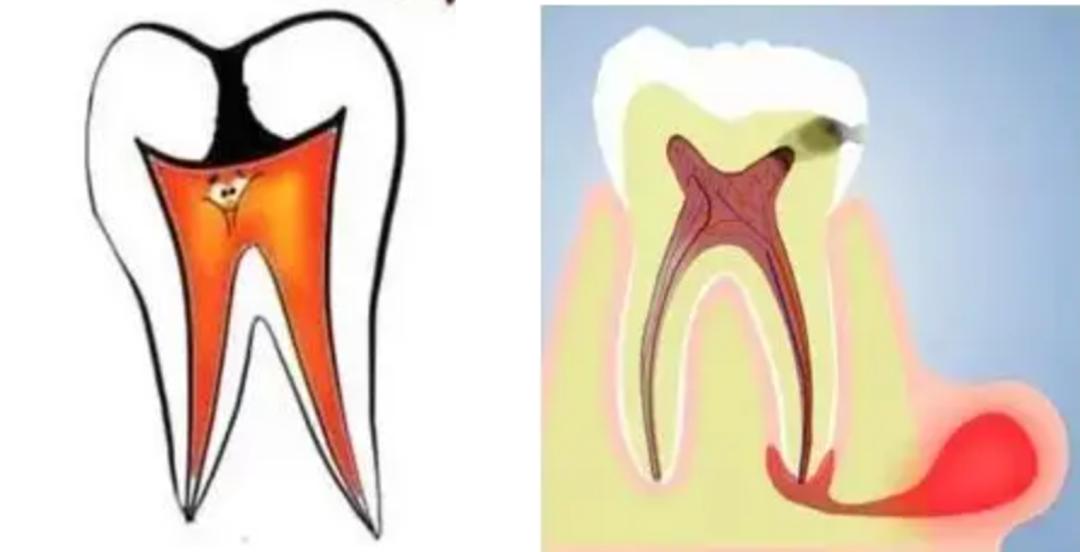 孕期口腔疾病对胎儿有什么影响,孕期口腔炎症会影响胎儿吗