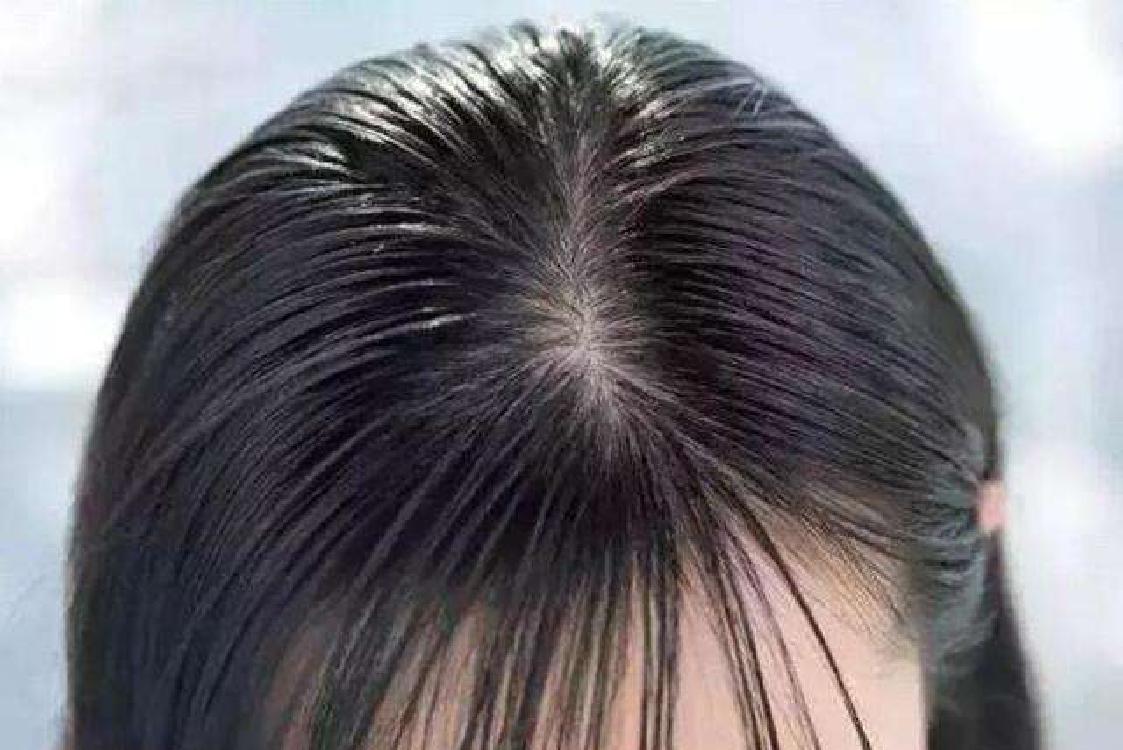 头发怎么看健康状况,头发健康的奥秘