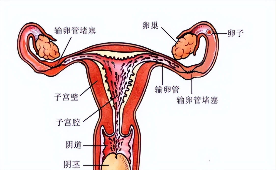 女人输卵管堵塞能治好吗,女人输卵管堵塞是什么原因