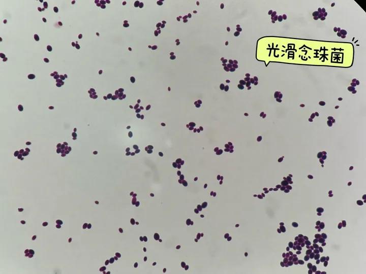 经常穿紧身内裤的坏处,经常穿紧身裤子对身体有影响吗