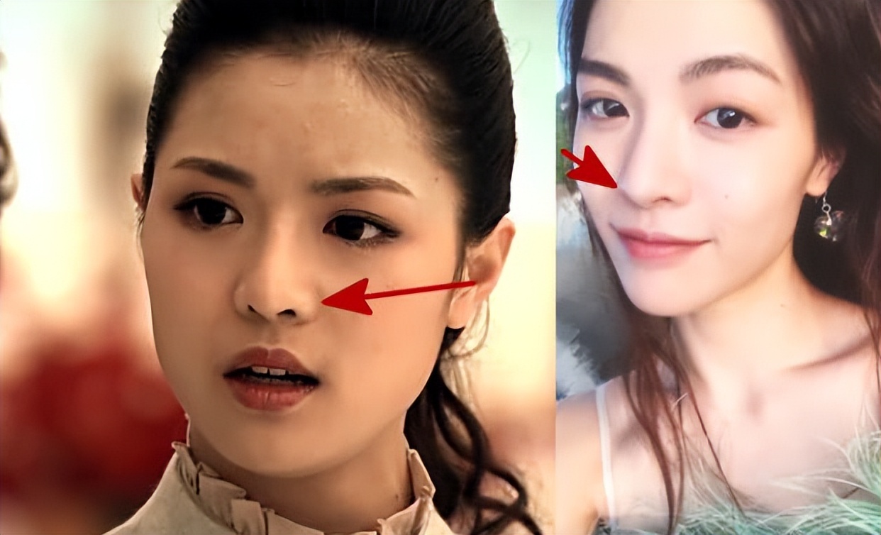 从“相貌平平”到千娇百媚，这7位女星的脸，前后差距让人破大防