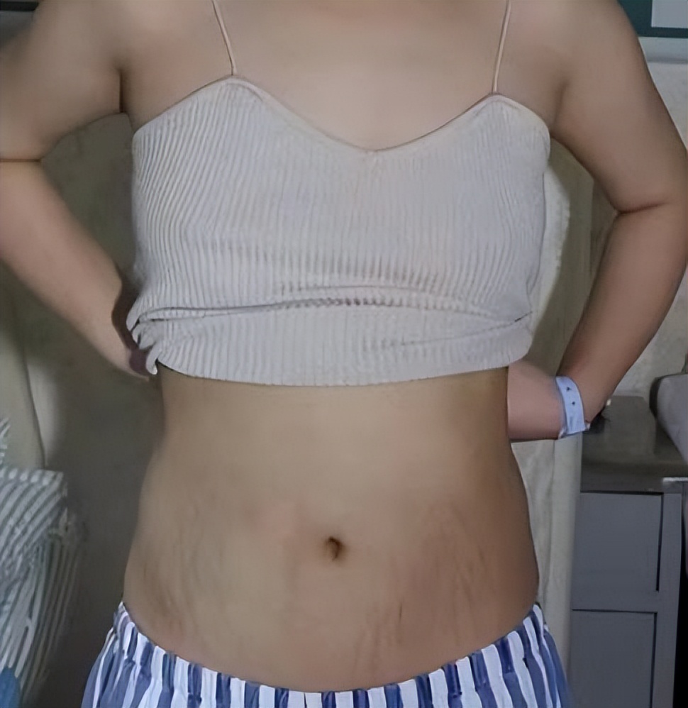 6款妊娠油推荐,妊娠油乳