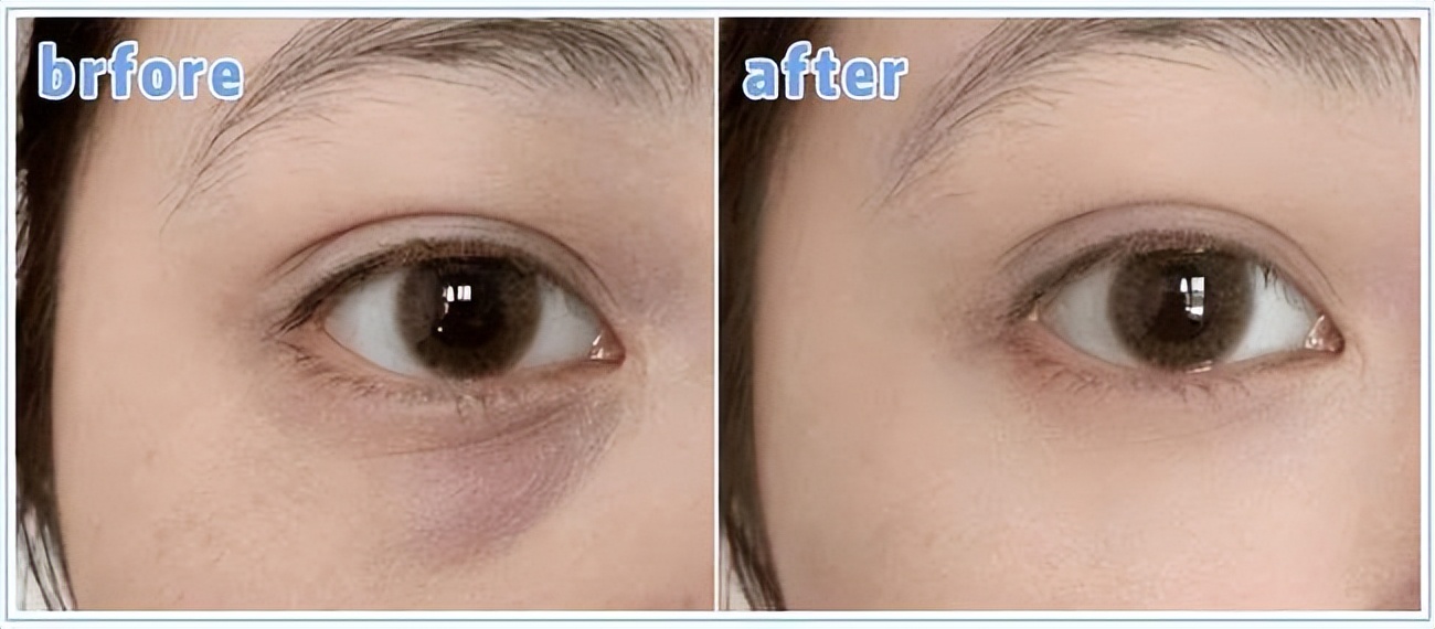 楂樺ア鍏ラ棬鎶よ偆鍝佹湁鍝簺,浣犱笉鐭ラ亾鐨勯珮濂㈡姢鑲ゅ搧