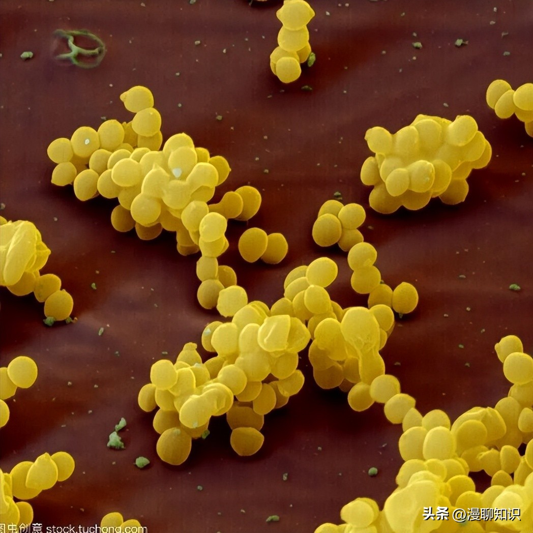 牦牛是高山地区牛的独特品种，肉质鲜嫩，但却饱受葡萄球菌的侵害