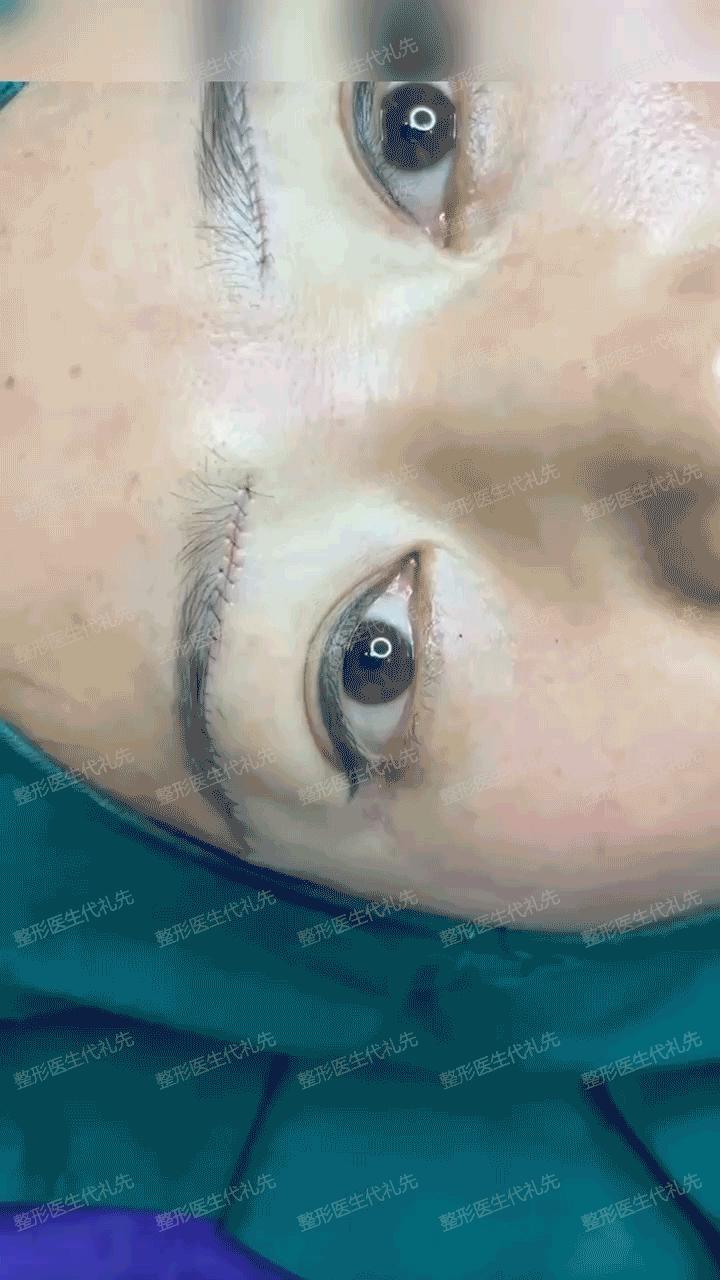 40岁以后为什么眼睛变小了,年轻人眼睛变小了怎么回事