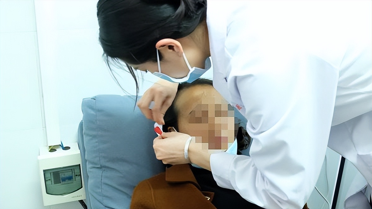 159元的智能失眠治疗仪,医用失眠治疗仪