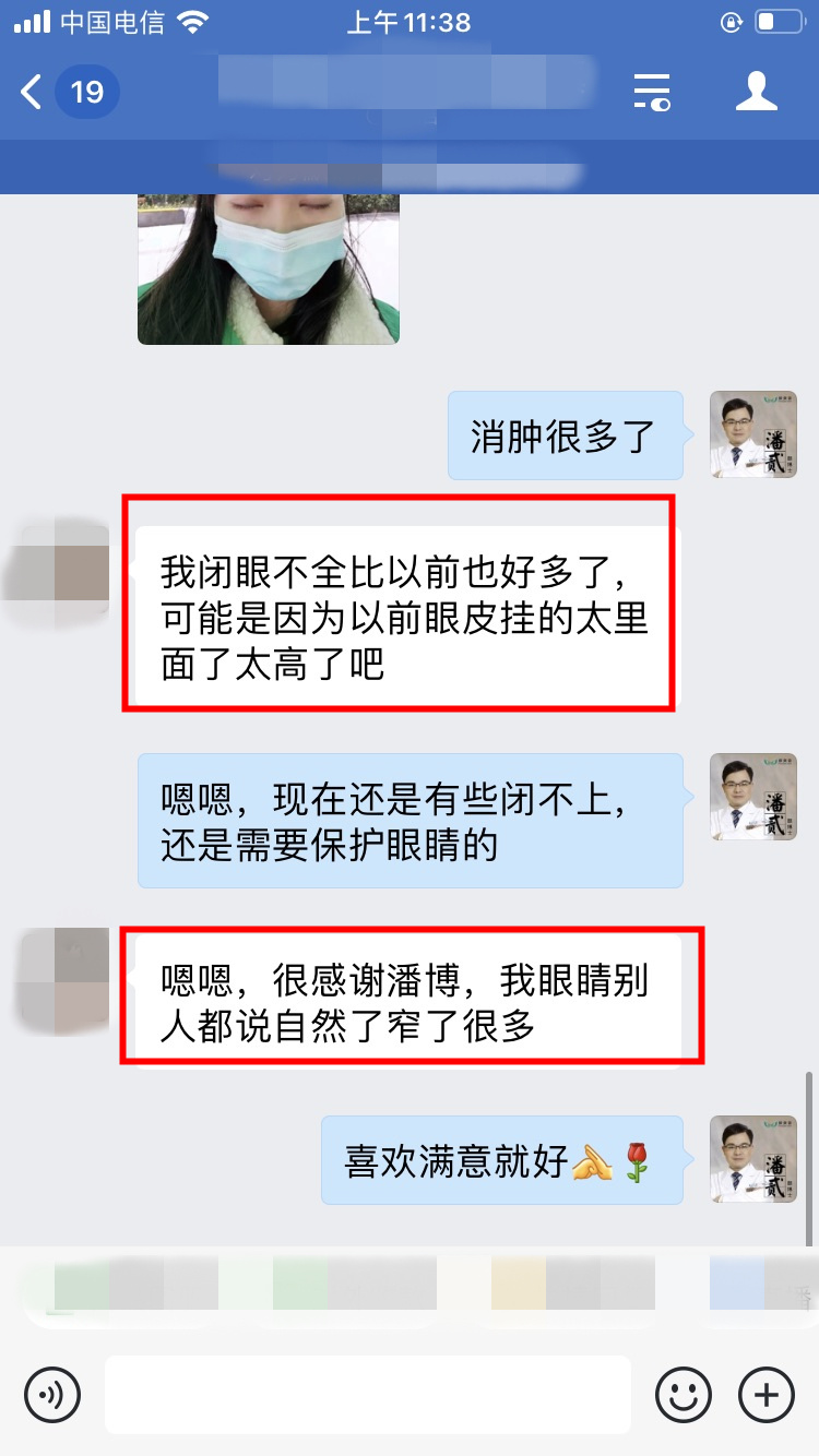 整容后眼睛不能闭合,整容失败眼睛无法闭合