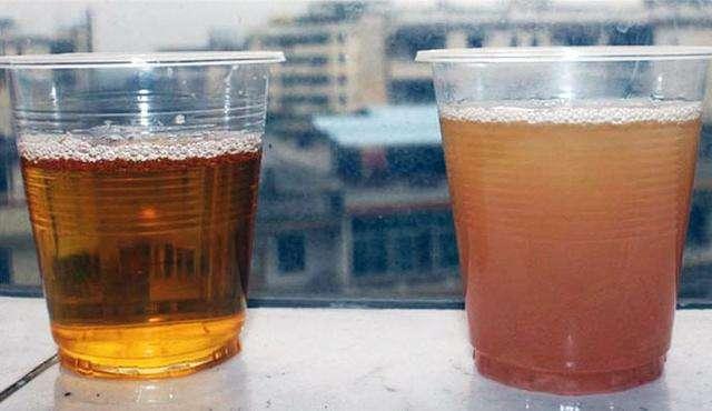 排尿很黄异味很大是什么病的信号,排尿很黄还有分泌物怎么回事