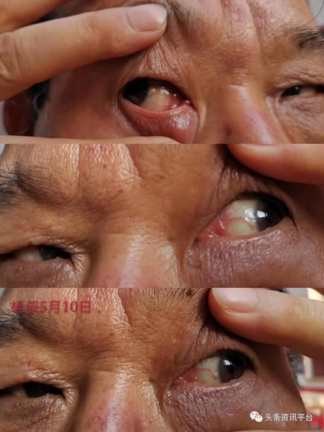 汉方优视真的有用吗,汉方视康