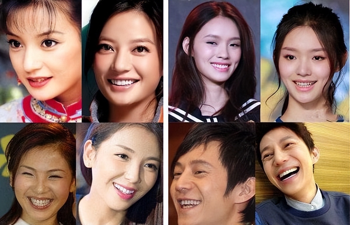 瘦到脸部凹陷到底好不好看,瘦到五官凹陷