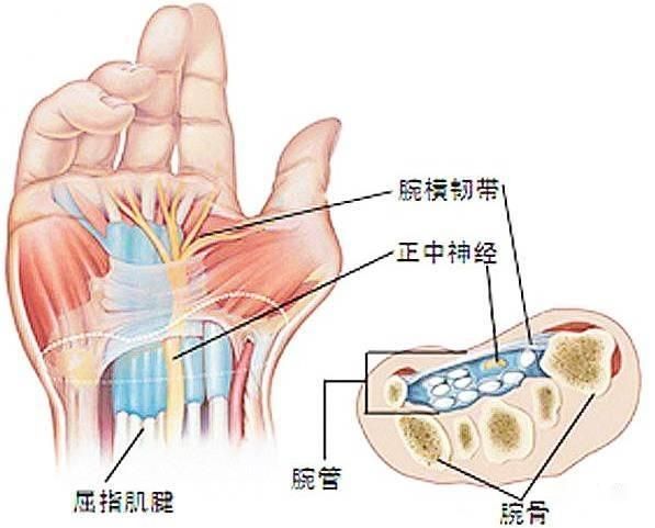 鼠标手腕管综合征挂什么科,白领鼠标手腕管综合征