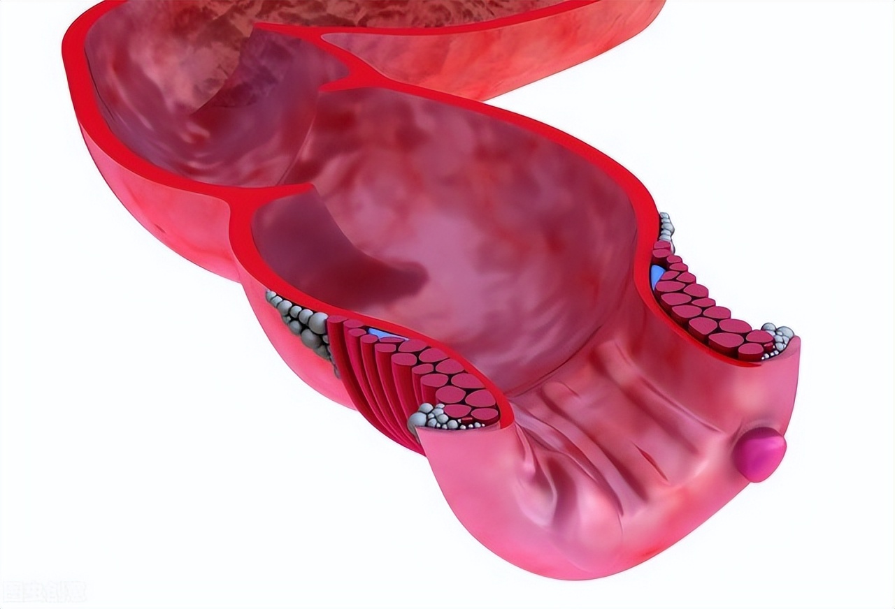 痔疮手术拉屎后要涂药,痔疮手术后拉屎困难用什么开塞露