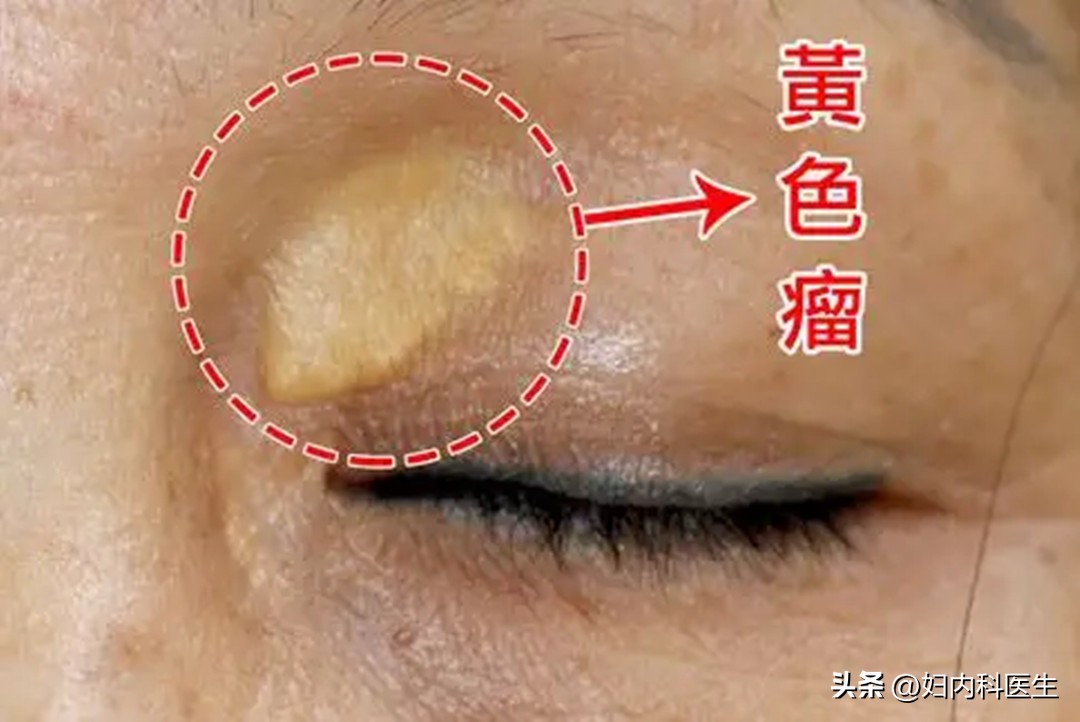 从脸色看出得什么病,面色反映一个人的健康