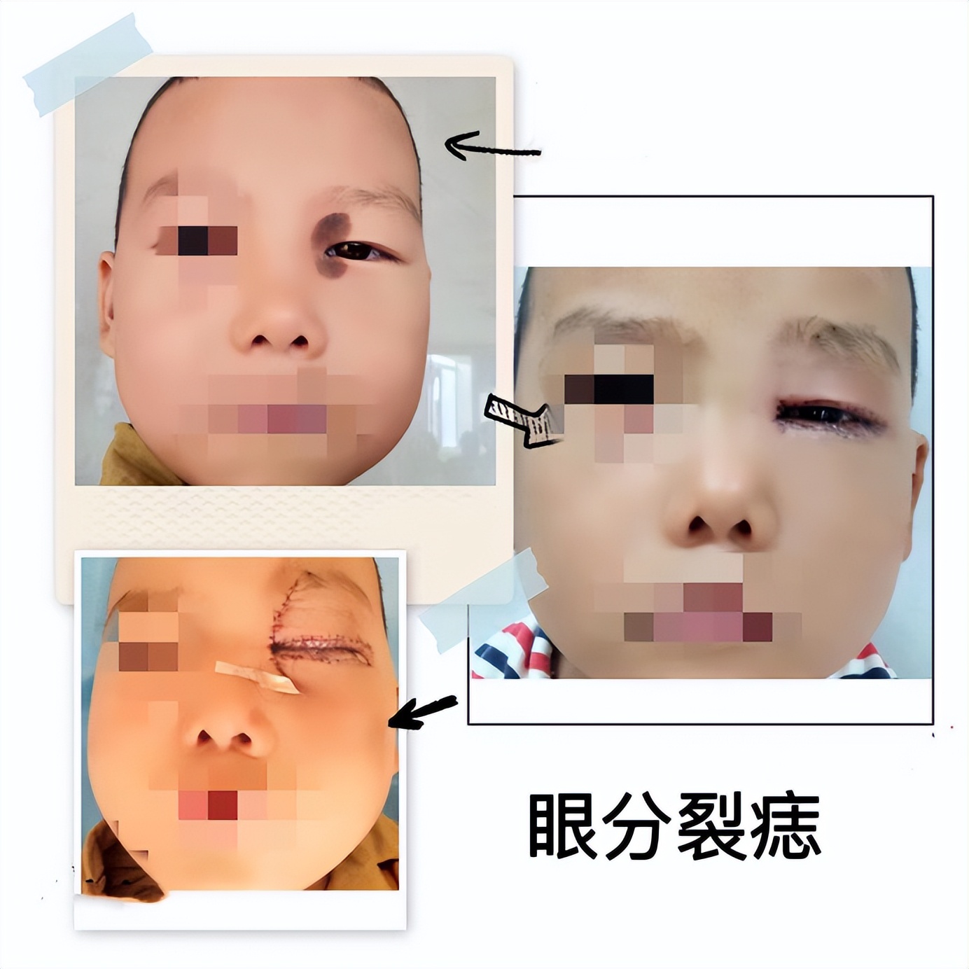 夏天美容整形,医院美容护肤项目