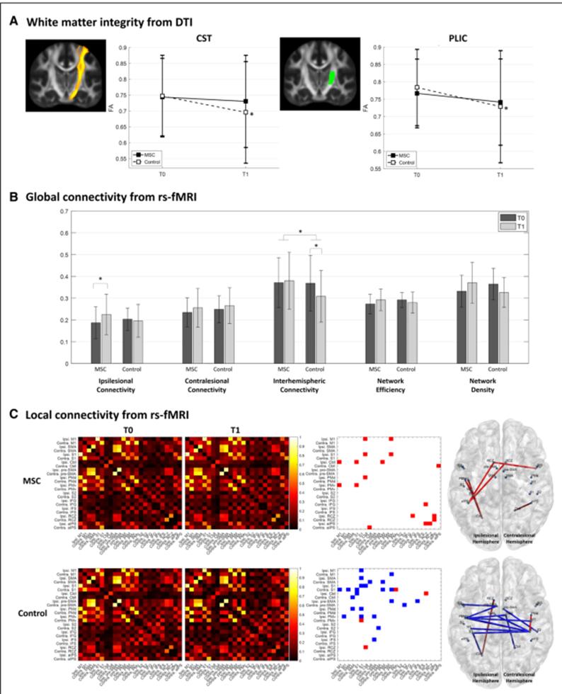 干细胞治疗脑疾病案例,干细胞治疗脑卒中3期临床试验