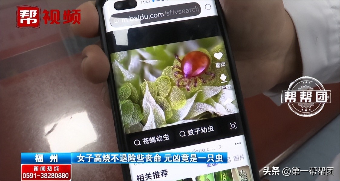 女子被恙虫叮咬持续高烧40度,福建被虫子咬到哪里医院好