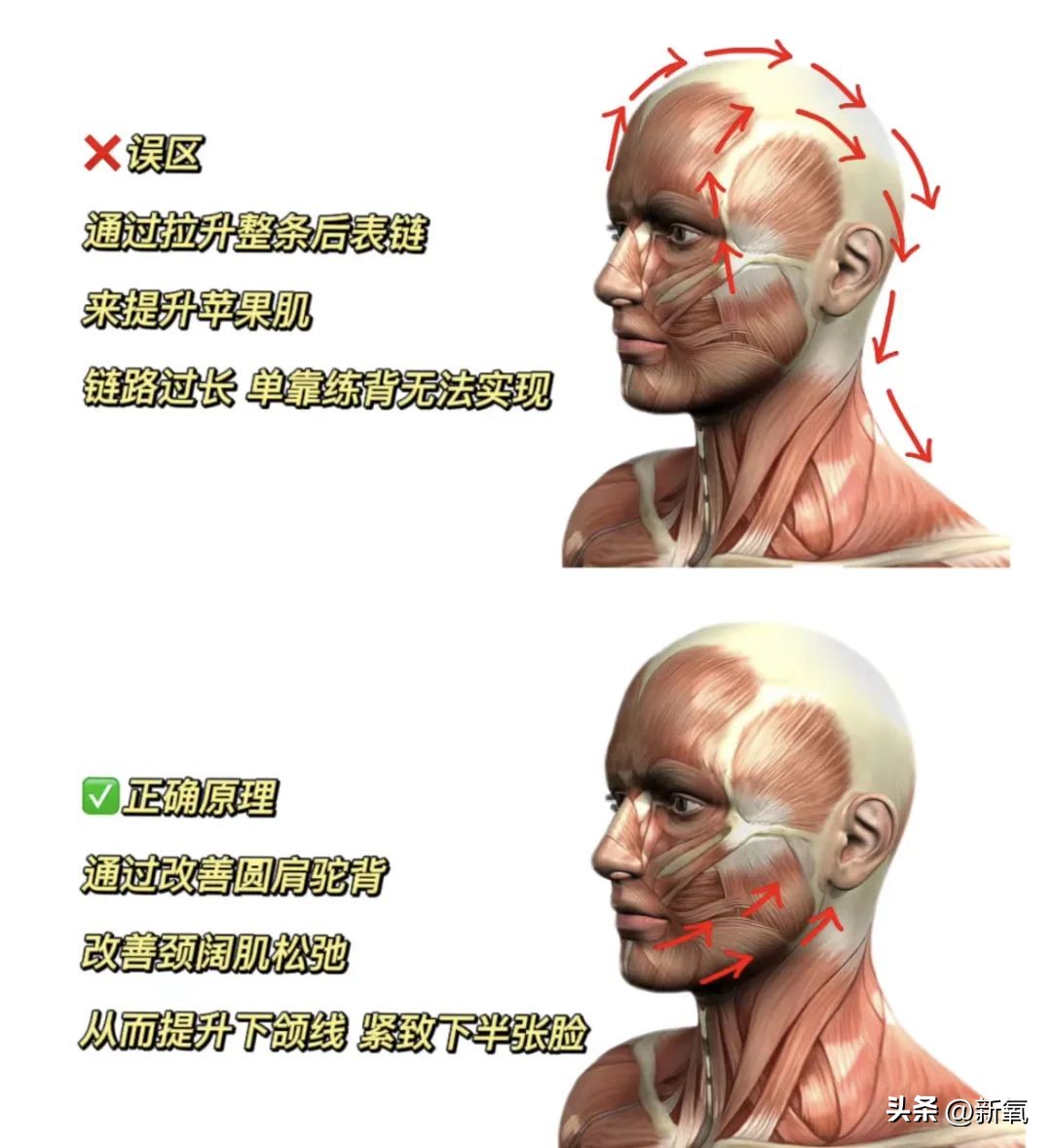 脸太下垂,脸下垂了是不是就显胖