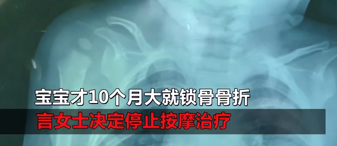 女子做胸部按摩护理,胸部按摩出血