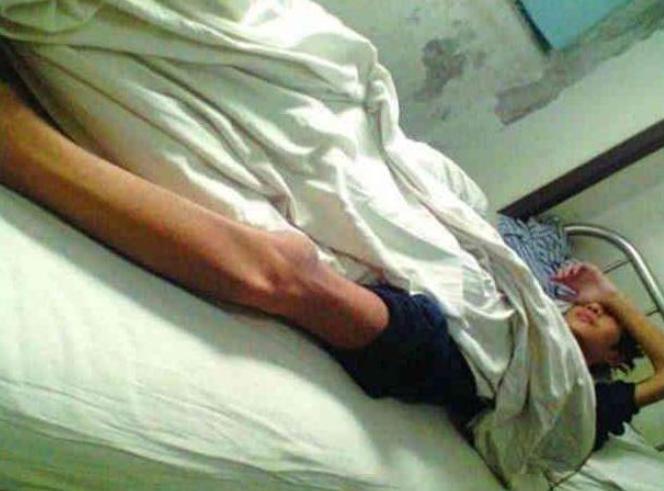 当年卖肾换苹果的男孩还在吗,当年卖肾换苹果小伙去世