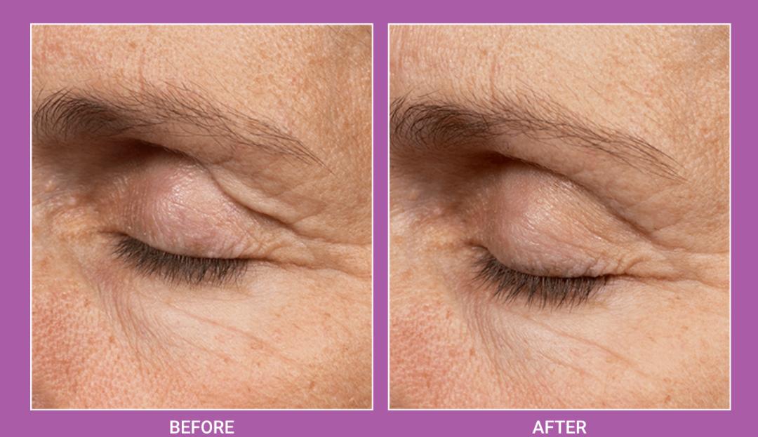 被亚洲富婆捧上纽交所的热玛吉，在海外真的吃香吗？