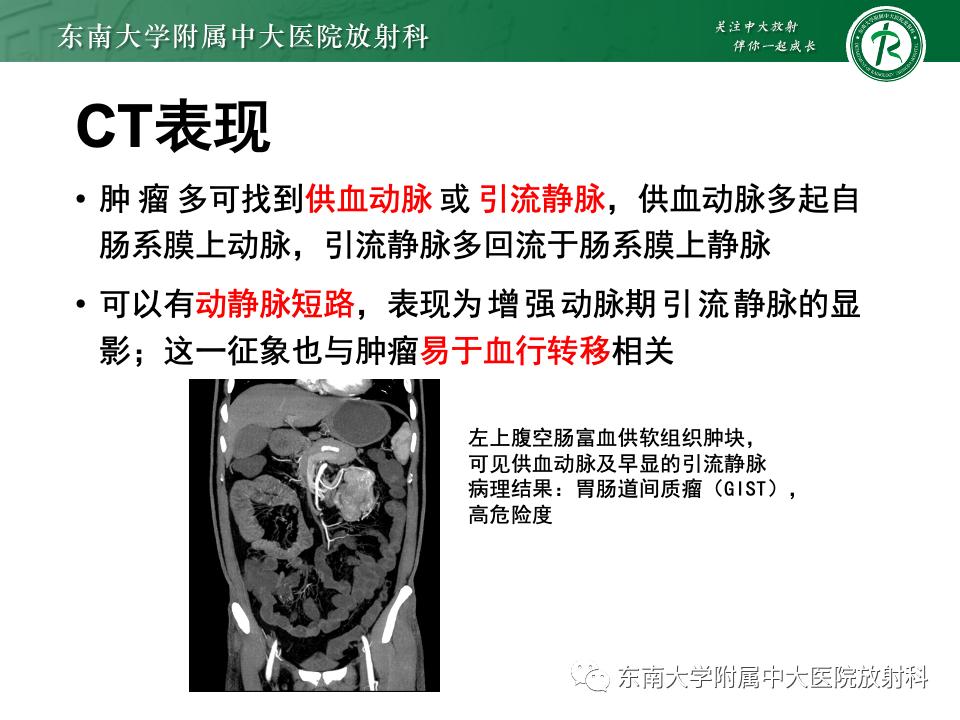 小肠间质瘤最新治疗中药方,小肠间质瘤基因检测