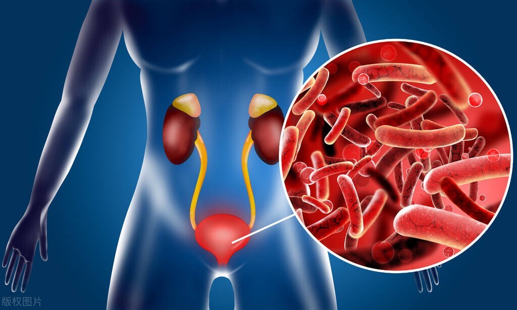 看肾好不好，尿检报告解读请收好。