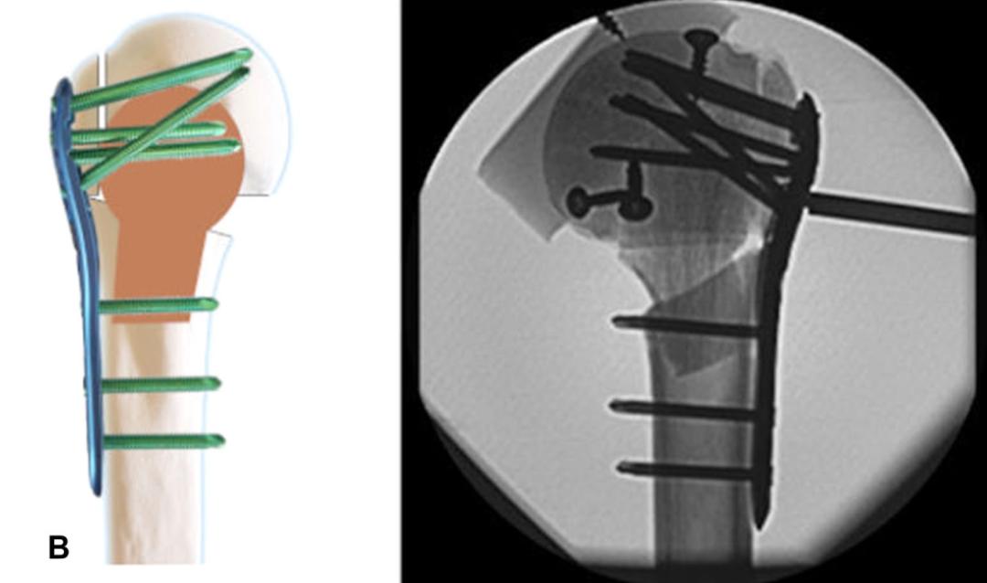 楠ㄧ闄堝崕,闄堝崕鍦ㄥ尰闄㈢殑瑙嗛