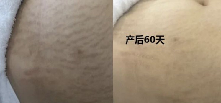 孕期好物分享爆款榜第一名,新手孕期妈妈必备好物