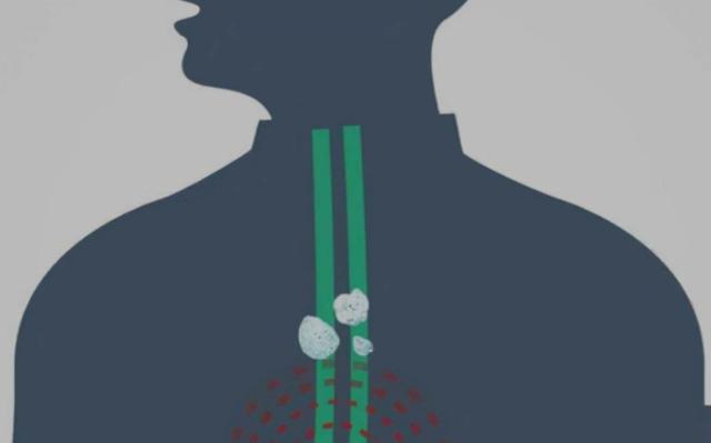 黄痰是寒痰热痰用什么药,黄痰是热白痰是寒