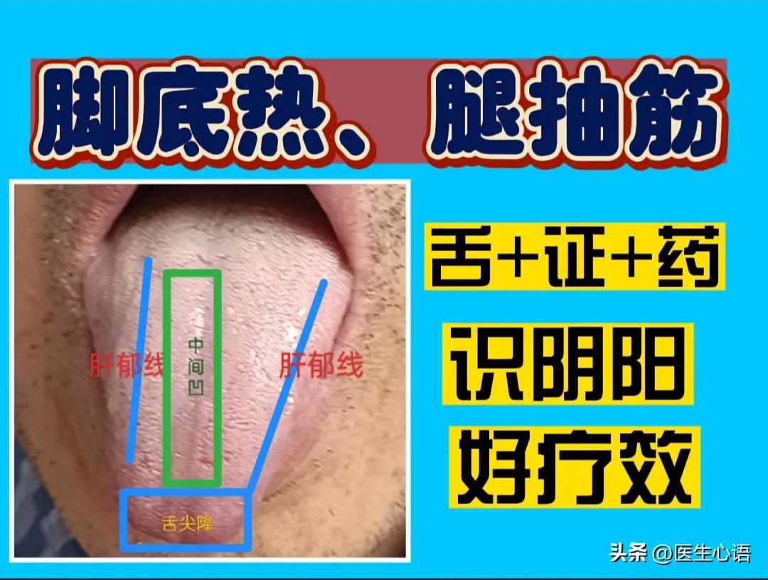舌诊寒湿吃啥中成药,舌诊及对应方剂大全