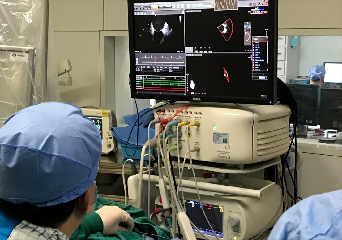 室上速儿童射频消融术最佳年龄,儿童做室上速心脏射频消融哪里好