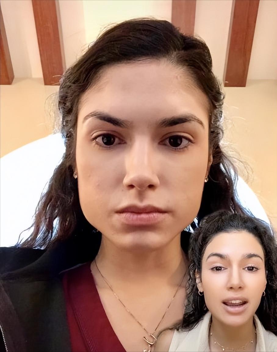 为什么都很讨厌网红脸,是不是所有人都不喜欢脸红