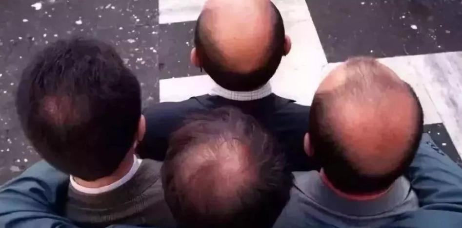 一夜间全村遭鬼剃头,山村鬼剃头真相