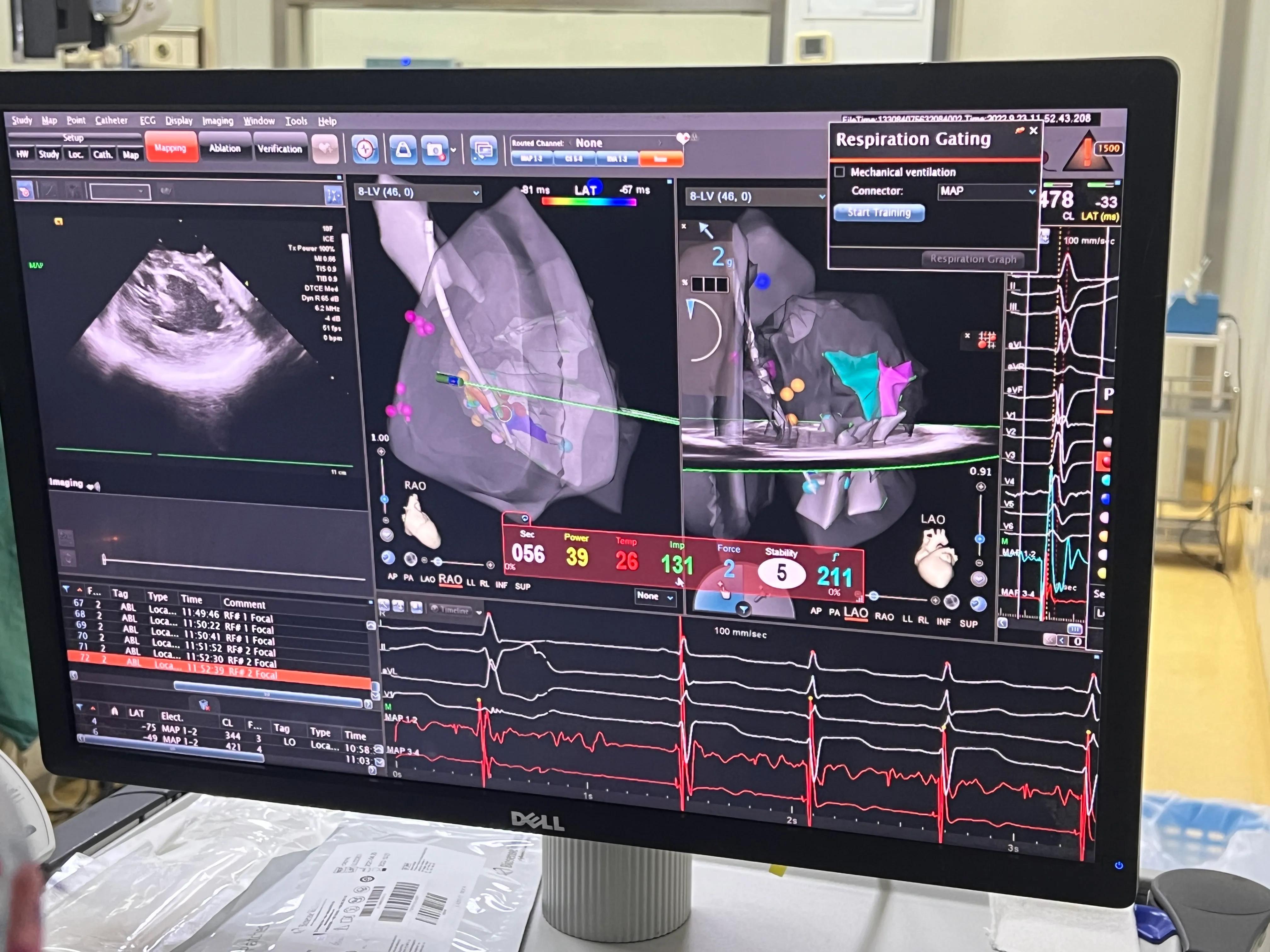 胸闷气促病例分析,小孩胸闷气短去检查说有炎症